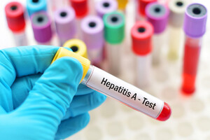 На Тернопільщині зафіксували випадок гепатиту А