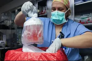 Перша людина із пересадженою від свині ниркою померла через два місяці після операції