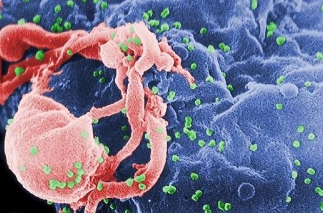 Біологи вперше отримали тривимірне зображення оболонки вірусу ВІЛ