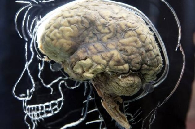 Британські вчені виявили у головному мозку область, що відповідає за совість