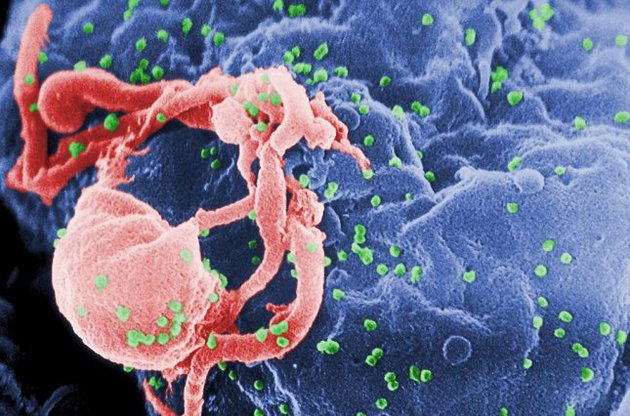 Вчені успішно випробували щеплення від ВІЛ на мишах