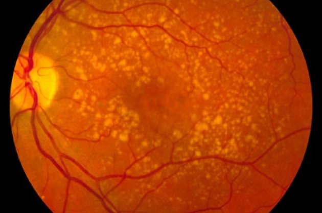 Ученые вырастили колбочки глаза человека из стволовых клеток