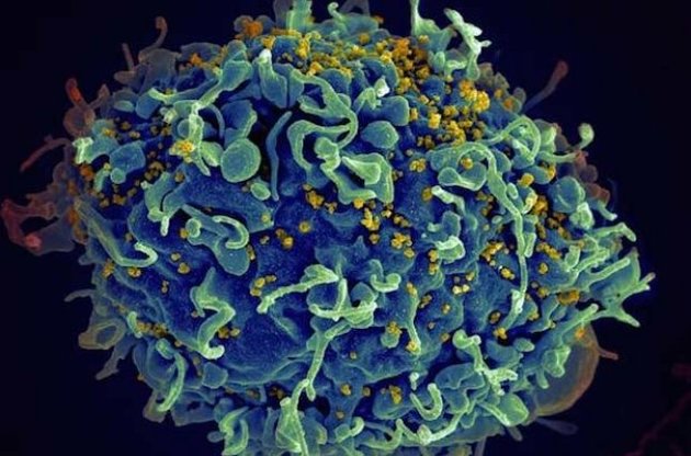 Ученые впервые увидели проникновение ВИЧ в ядро клетки