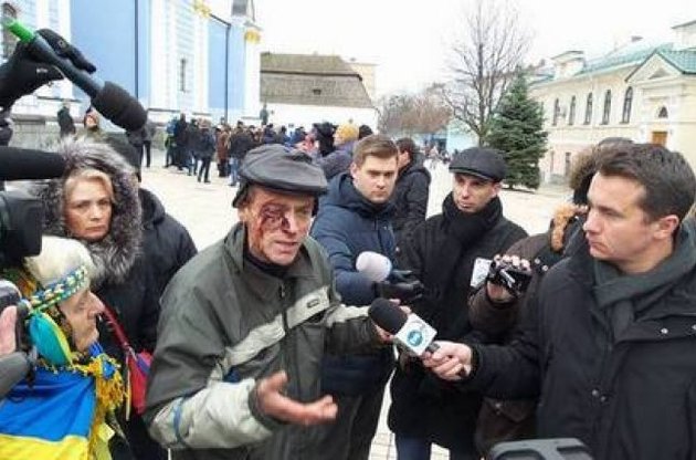 Число пострадавших в стычках с "Беркутом" в центре Киева выросло до 165