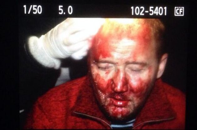 В ході штурму на Банковій постраждали близько 10 українських та іноземних журналістів