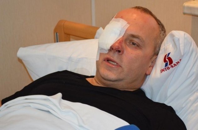 Шуфрич ще ввечері виписався з лікарні і полетів у Київ чартером - ЗМІ