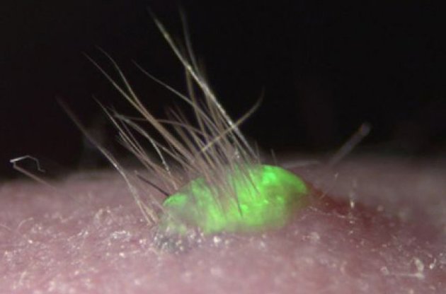 Вчені вперше виростили волосся на штучній шкірі