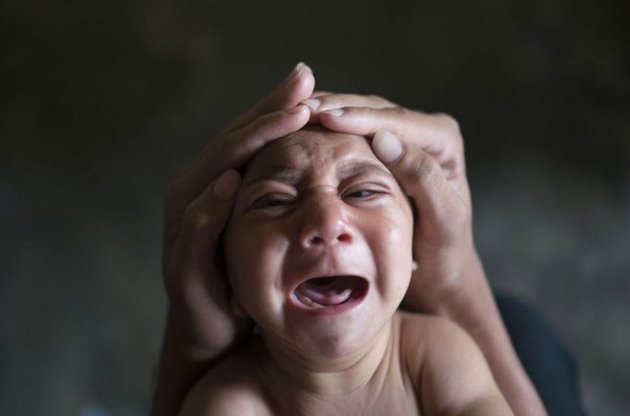 Вирус Зика вызывает у младенцев слепоту – ученые