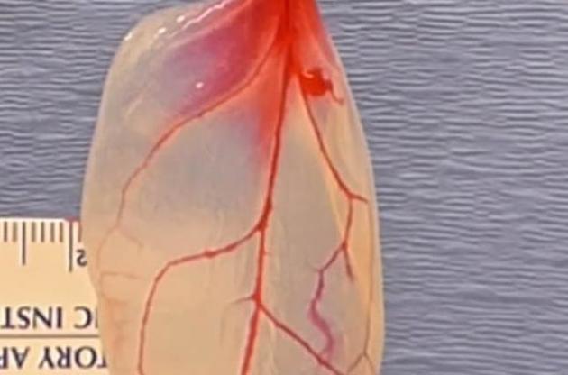 Ученым удалось создать ткани сердца человека из листьев шпината