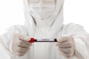 В Украине за сутки обнаружили 12 496 новых случаев заражения коронавирусом