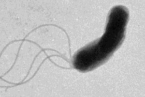 Ученым удалось выяснить, как двигаются бактерии