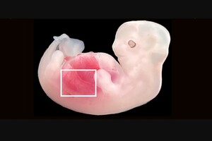 Ученым удалось вырастить человеческие почки в эмбрионах свиней