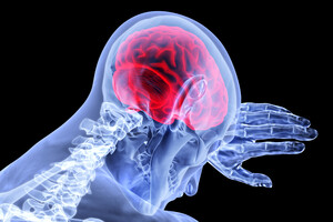 Хвороба Паркінсона та інші порушення в мозку можуть бути пов'язані з нанопластиком – вчені