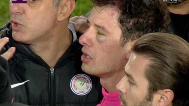 Все футбольные матчи в Турции приостановлены из-за избиения арбитра