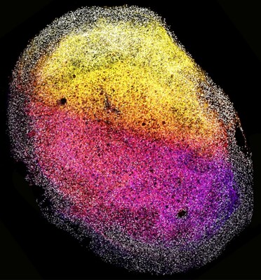 Ученые создали «мини-мозги» из настоящих клеток