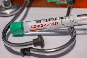 Епідпоріг захворюваності на ГРВІ, грип і COVID перевищено у трьох областях
