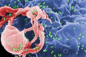 Биологи впервые получили трехмерное изображение оболочки вируса ВИЧ