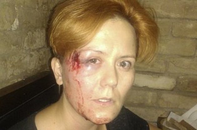 Лидер движения FEMEN Анна Гуцол