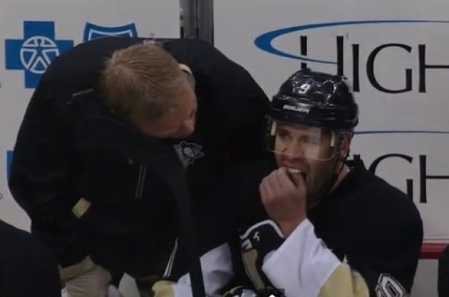 Паскаль Дюпюї вирвав собі зуби прямо на лавці запасних