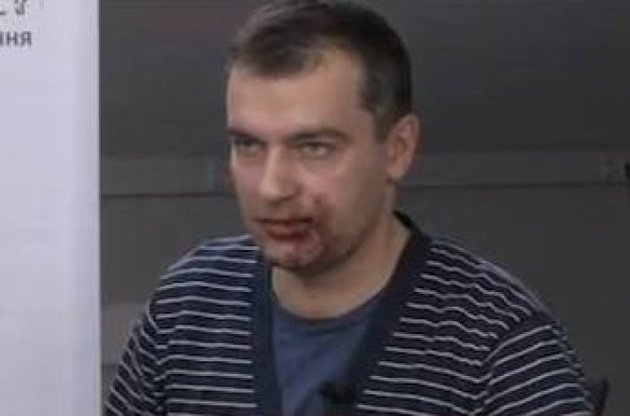 Дмитрий Гнап после столкновения с &quot;титушками&quot;