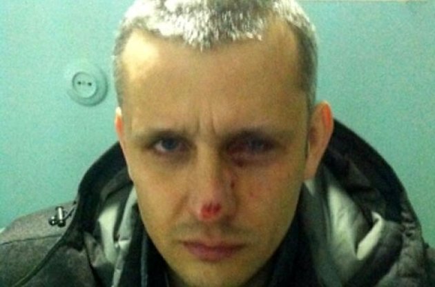 У Києві під час протистояння вбили журналіста