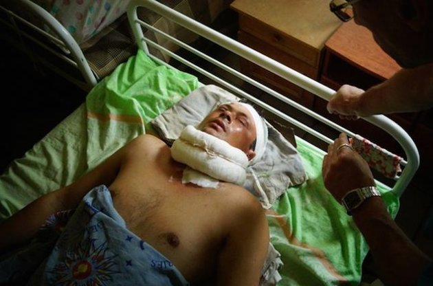 Чехія готова прийняти поранених українських військових