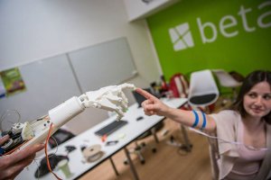 Бионический протез заменил жительнице Лондона живую руку