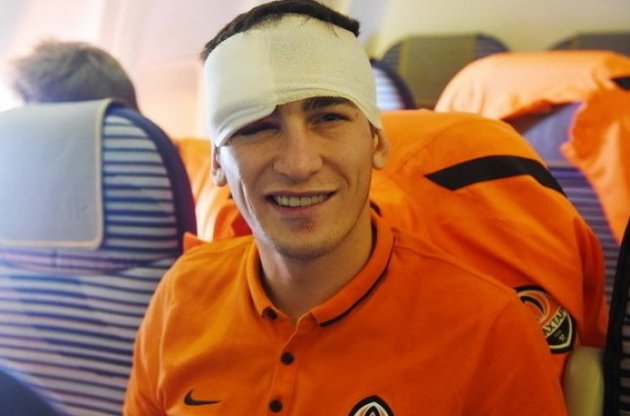 Степаненко після травми в матчі з "Рапідом" уникнув струсу, але поки не може відкрити око