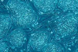 Ученые научились управлять развитием стволовых клеток при помощи лазера