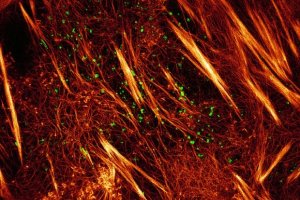 Вченим вдалося зняти відео руху білків у живій клітині