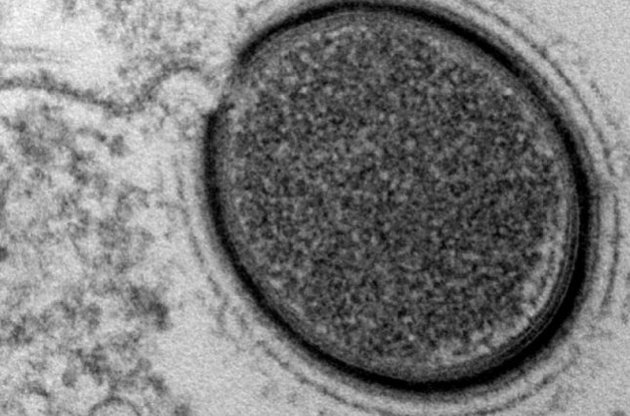 В сибирской мерзлоте обнаружен древний гигантский вирус