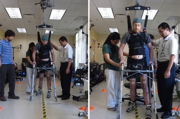 Парализованный мужчина восстановил способность ходить с помощью передатчика мозговой активности