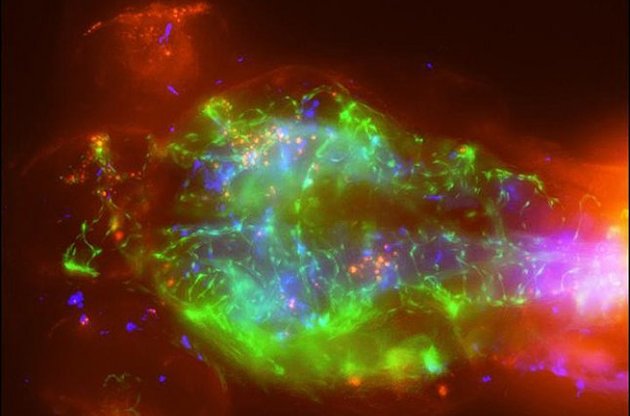 Вчені зняли відео зараження мозку криптококовим менінгітом