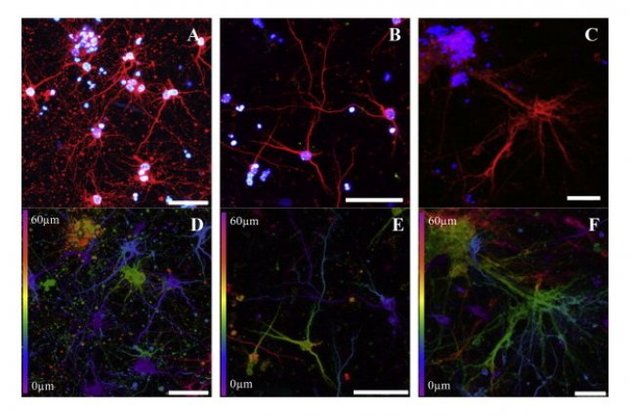 Ученые определили контролирующие быстрый сон нейроны
