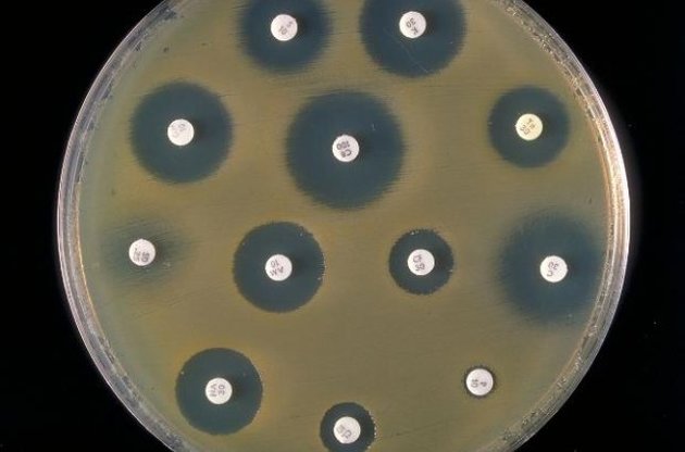 Чистые области вокруг антибиотиков демонстрируют их эффективность