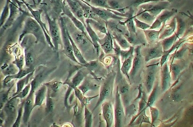 Ракові клітини &quot;вербують&quot; здорові для утворення пухлини