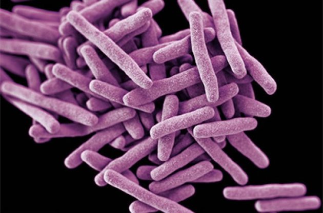 Ученые разработали простой тест для диагностирования заболевания туберкулезом