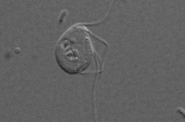 Monocercomonoides полностью лишены митохондрий