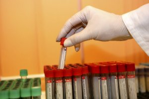 В Бразилии попросили не бояться вируса Зика во время Олимпиады