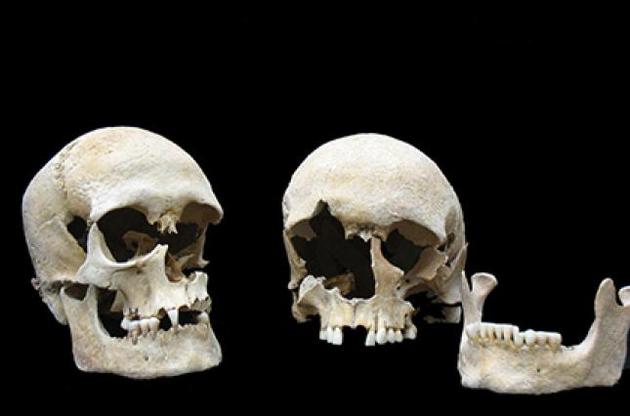 Вчені виділили ДНК чуми з решток людей, які жили у VI столітті