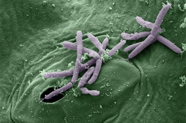 Ученые обнаружили новую устойчивую к антибиотикам бактерию