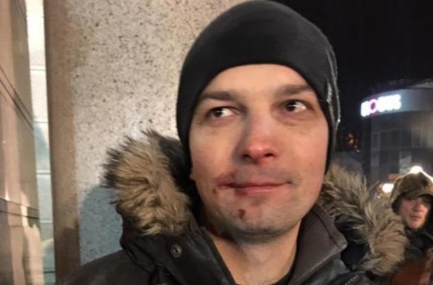 Під час зіткнень у центрі Києва Єгору Соболєву розбили обличчя
