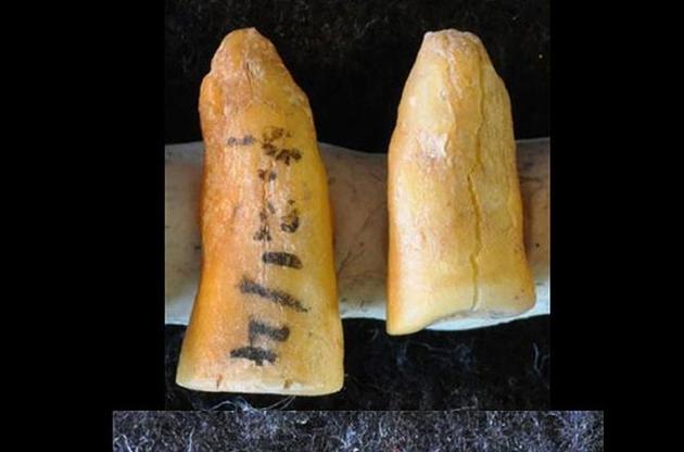 Археологи обнаружили зубные пломбы возрастом 13 тысяч лет