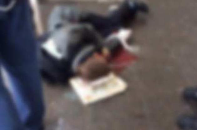 Від вибуху постраждав підліток