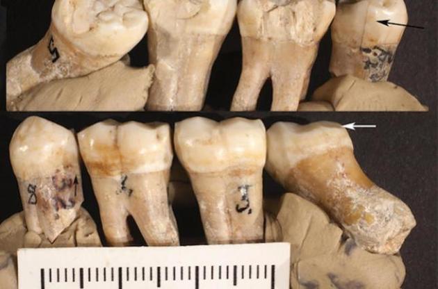 Ученые назвали неандертальцев изобретателями первых стоматологических инструментов