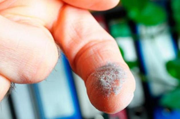 Пил може викликати ожиріння