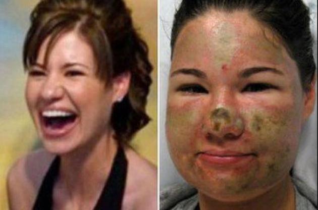 На вокзале во Франции туристок из США облили кислотой.