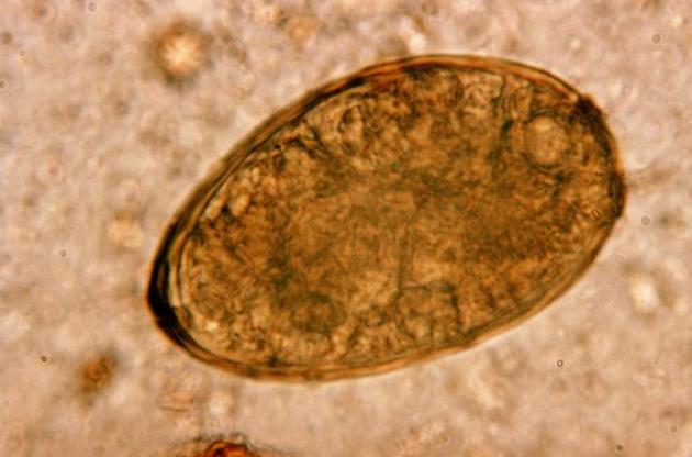 Вчені виявили паразитів у печінці мумії