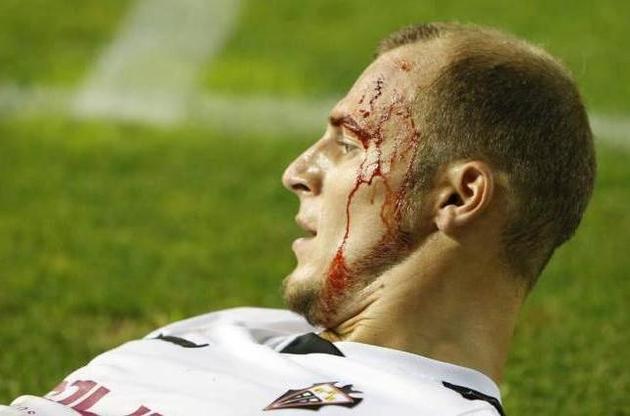 Зозуля разбил голову в первом матче за &quot;Альбасете&quot;