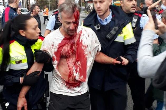 Власти Каталонии заявили о более чем 760 пострадавших во время столкновений с полицией